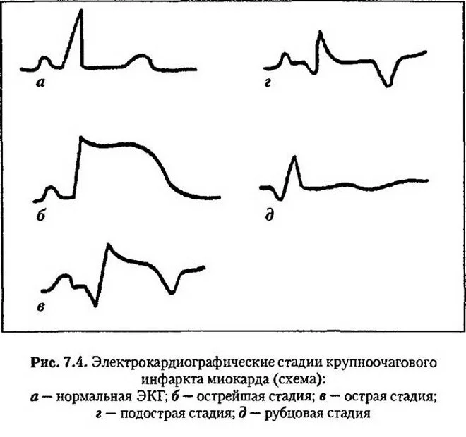 Card image 1