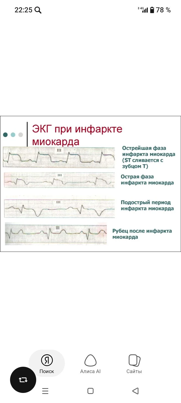 Card image 1